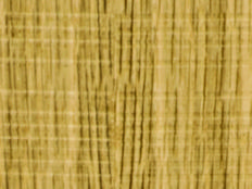 Greenpanel Veneers